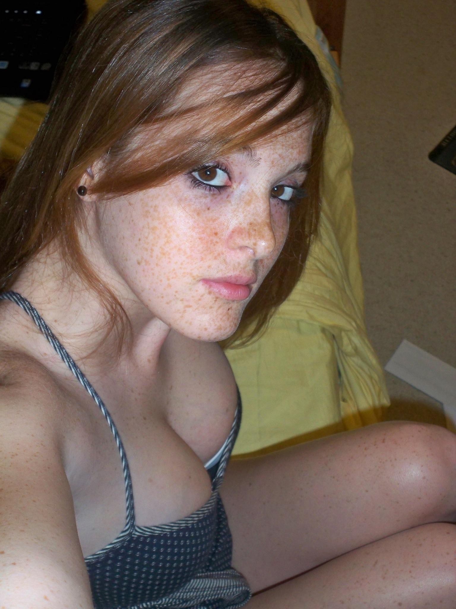 A Lot Of Freckles Porn Pic