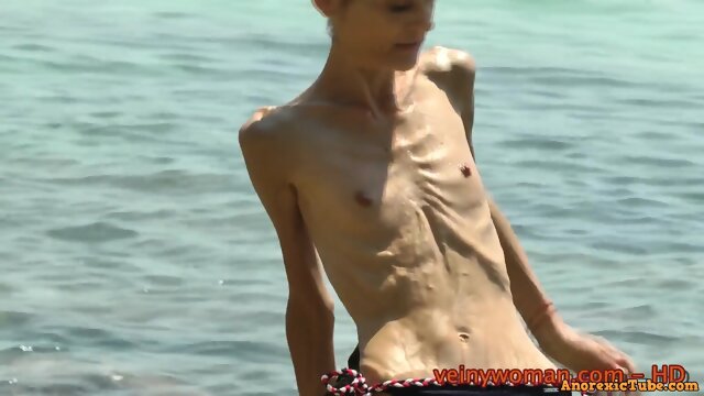 Anorexic beach