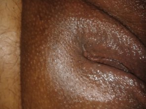 foto amateur Skin Close-up Brown Flesh 