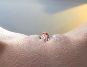 foto amatoriale Skin Close-up Red Finger 