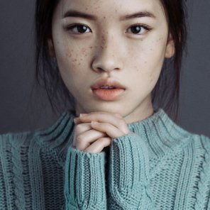 amateur photo Asians can have freckles too!