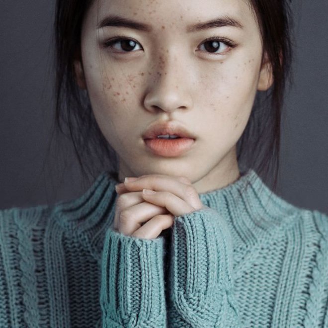 Asians can have freckles too!