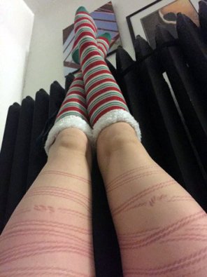foto amatoriale White Leg Red Human leg Arm 