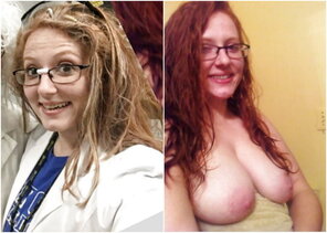 amateur pic before and after in glasses