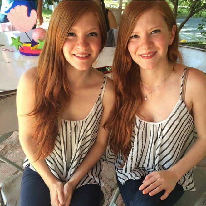 Twin gingers