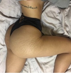amateurfoto Stretchmarks can be beautiful too