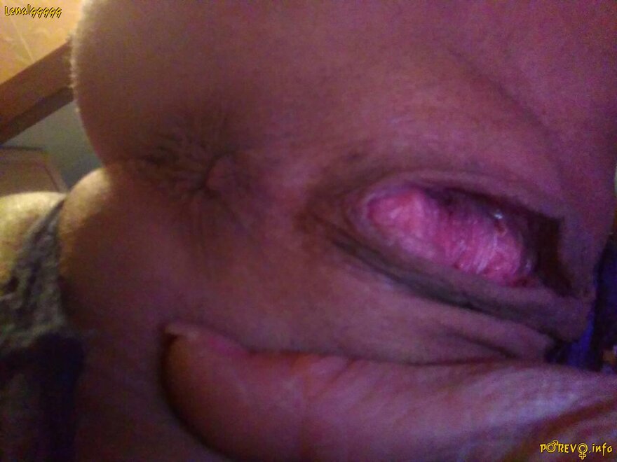 634034-2898830-krupniy plan_kiska nude