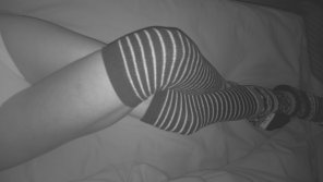 amateur-Foto White Black Leg Human leg Joint 