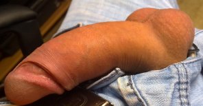 amateur-Foto Skin Finger Joint Hand Arm 