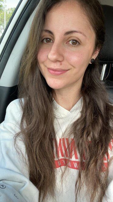 a little sunburnt and 1 week sober __