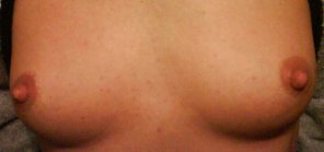 zdjęcie amatorskie Skin Close-up Cheek Nose 