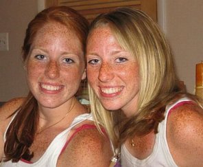 foto amatoriale A pair full of freckles
