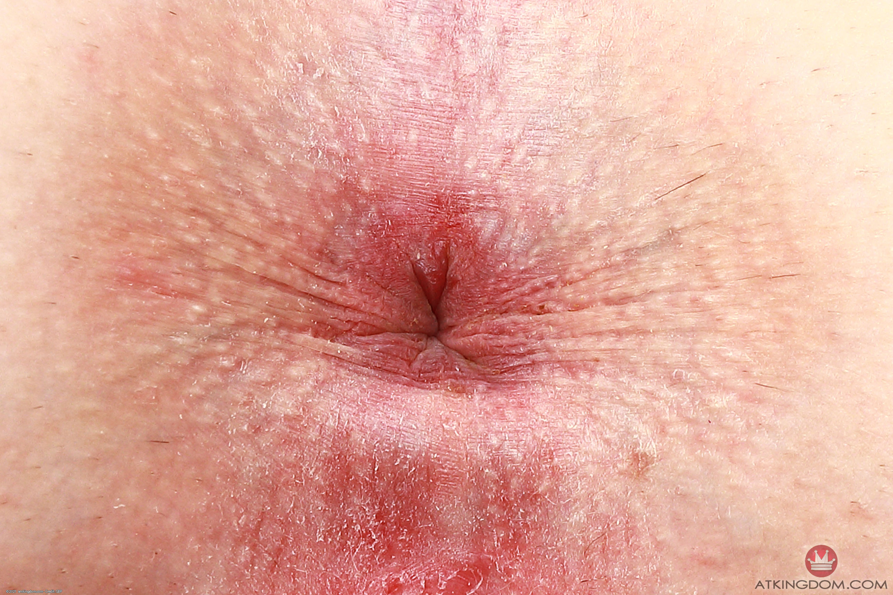 amateur photo mic134gbp_384183141