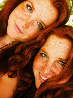 アマチュア写真 Fiery Freckles