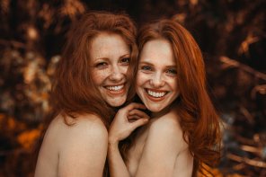 photo amateur A pair of freckled smiles
