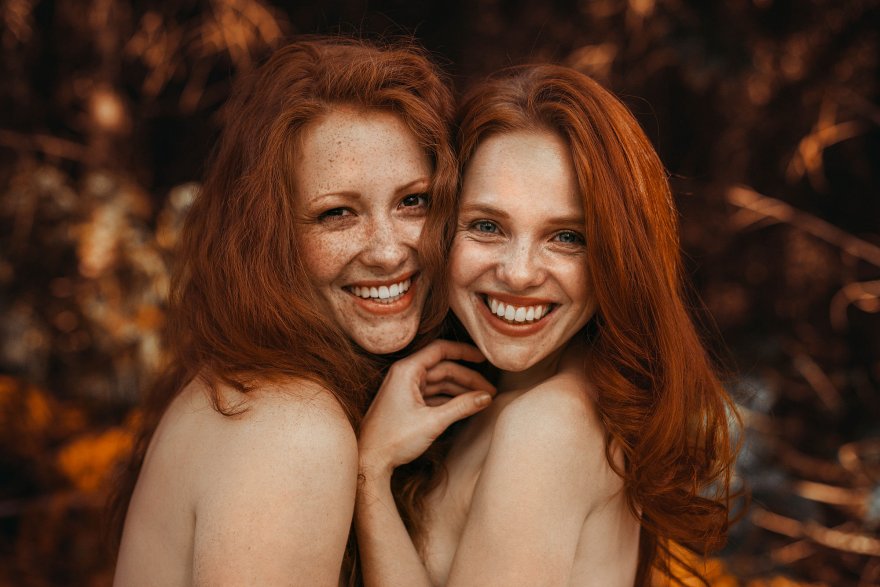 A pair of freckled smiles