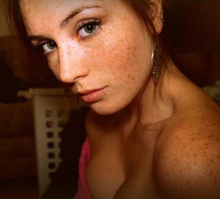 Shoulder freckles beauty