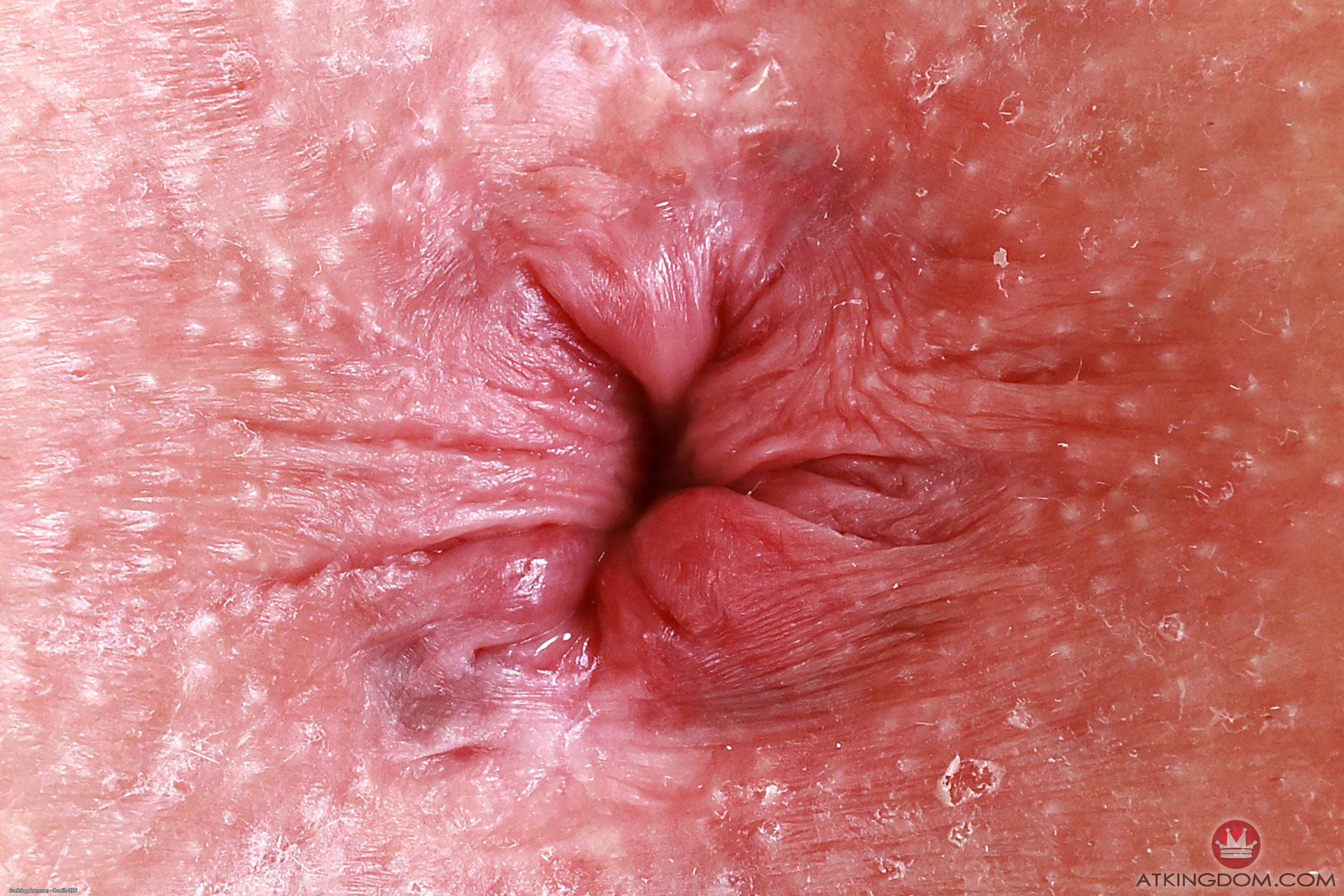 amateur photo mck005GBP_410917143