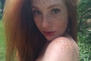 amateurfoto Face Hair Skin Lip Nose Freckle 