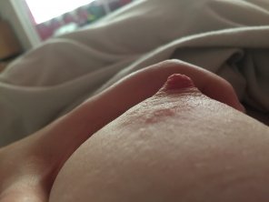 amateurfoto [19 F] They were all pointy when I woke up...