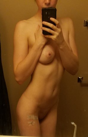 amateurfoto Getting the stitches out this week. Would you kiss my scars once they're healed?
