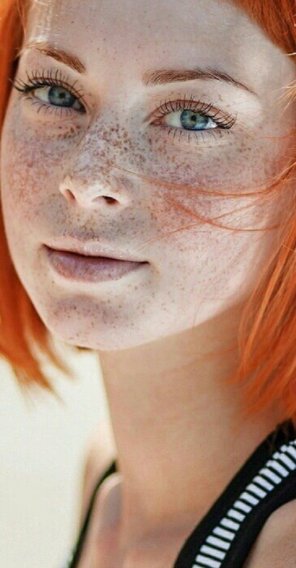 amateur-Foto Freckle overload.