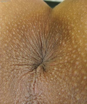 amateurfoto Skin Close-up Navel Flesh 