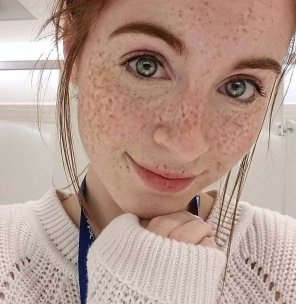 amateur pic A freckle or two