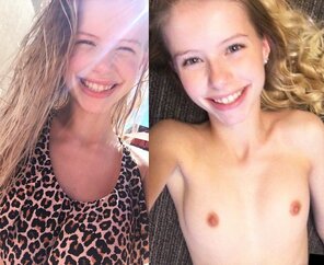 アマチュア写真 More Dressed and Undressed and Before and After