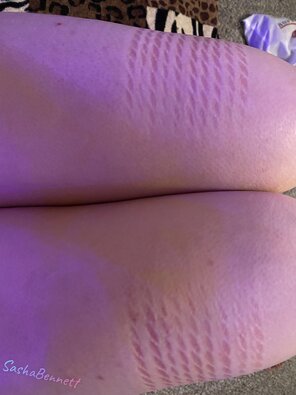 amateur pic I enjoy showing you all my marks ????
