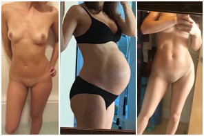 amateur-Foto Before, during, and 6 months after