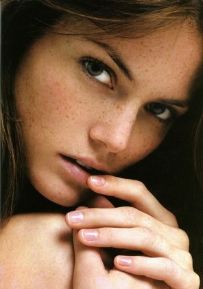 foto amateur Freckles