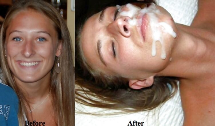 Before-And-After-Cum-Facials-15-752x440