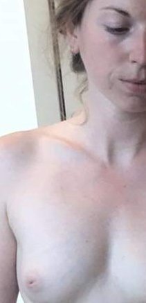 amateur pic Becky Fanus inverted nipple