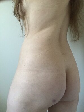 amateur pic Anybody else got bitten in the ass ? lol. [F]
