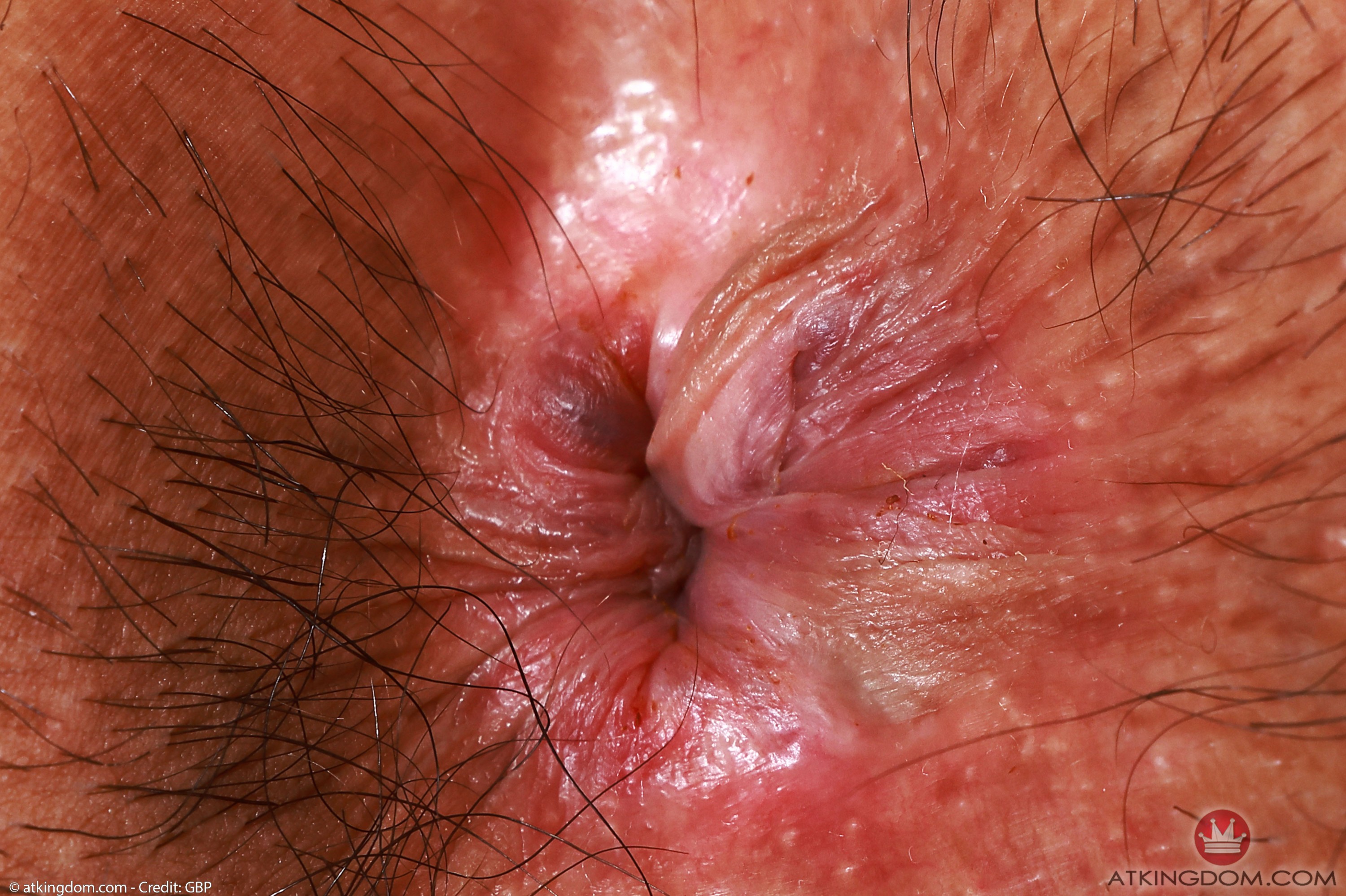 amateur photo 241342284_175