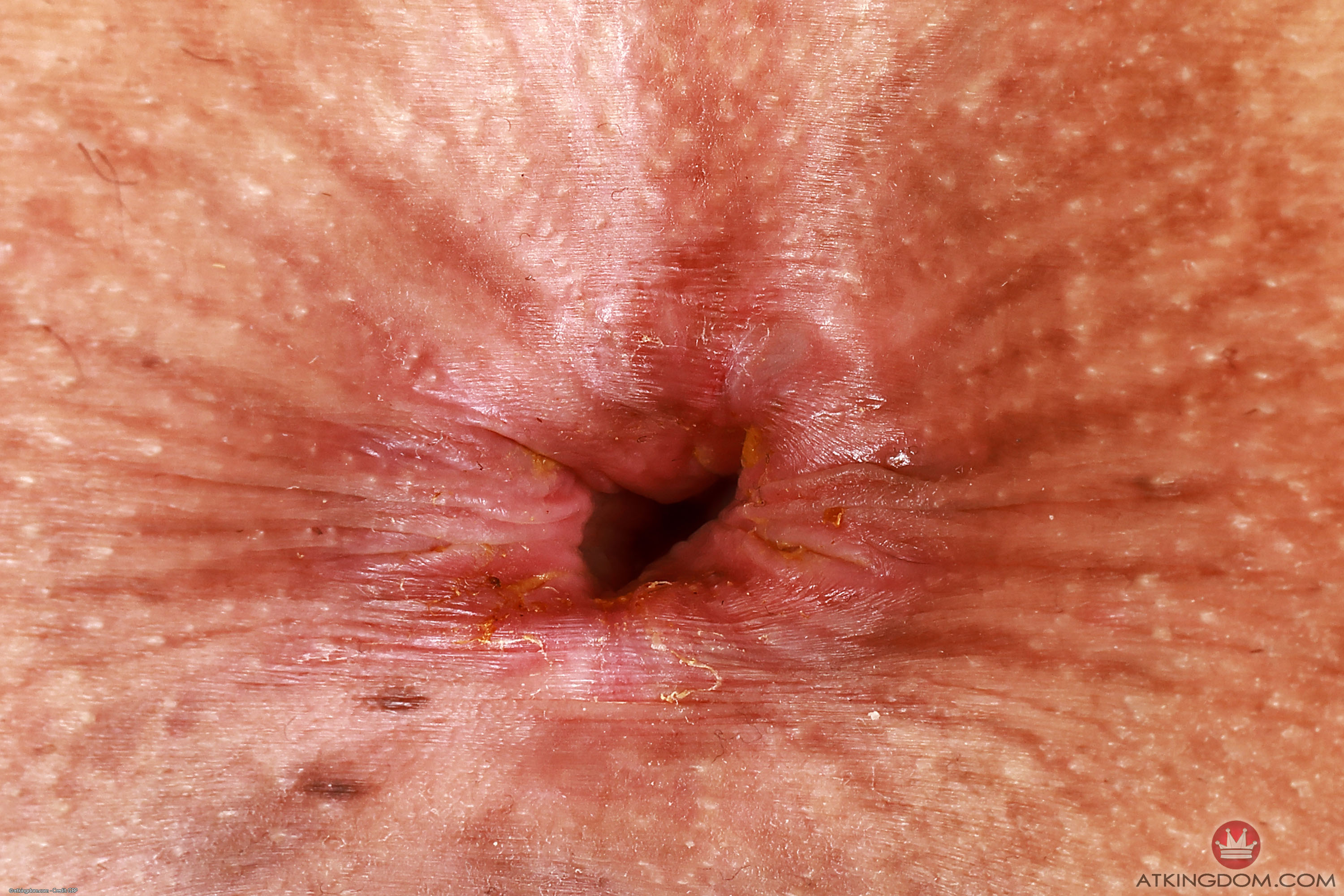 amateur photo mar433GBP_411010152