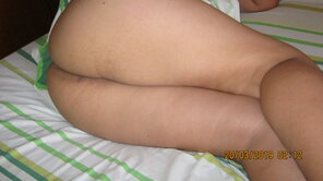amateur pic Skin Thigh Human leg Leg Close-up 
