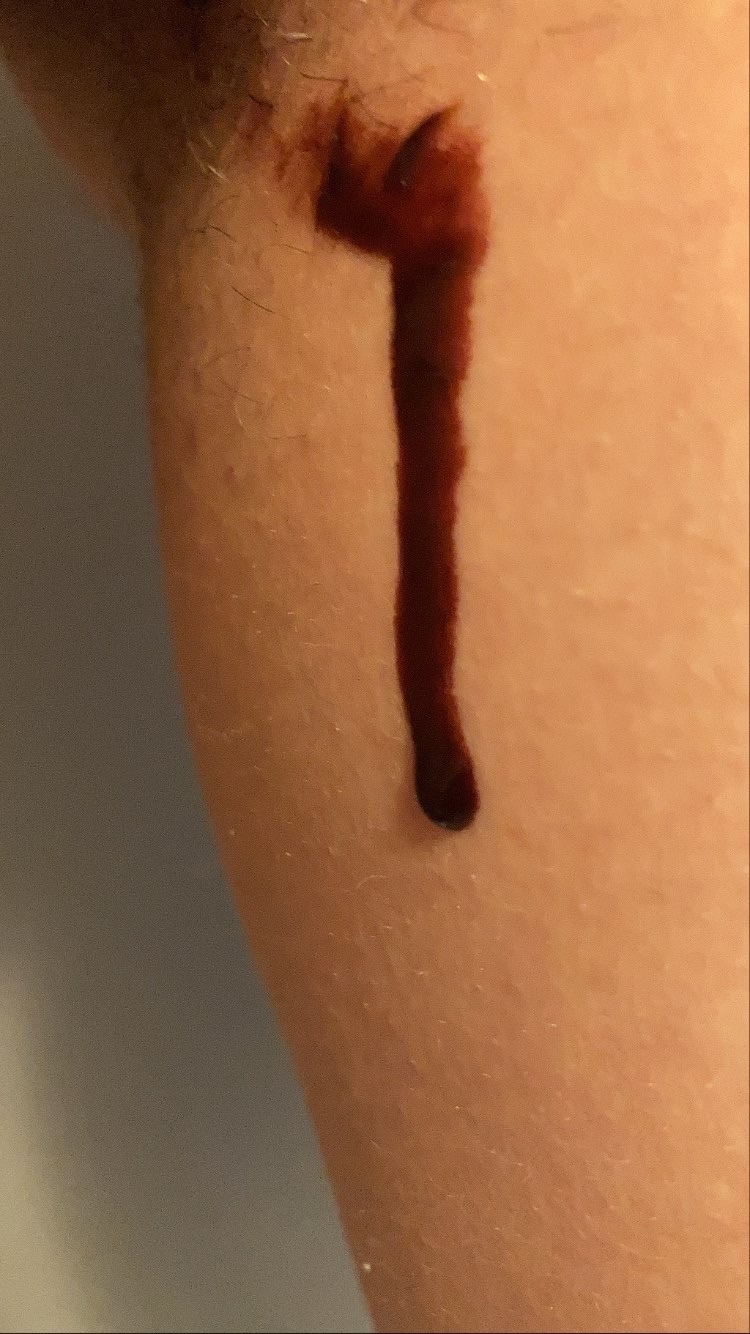 amateur photo F1214313-C3C7-49D8-BD79-089DB1BB1474