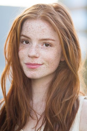 foto amatoriale Freckled