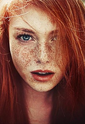 zdjęcie amatorskie Lots of freckles