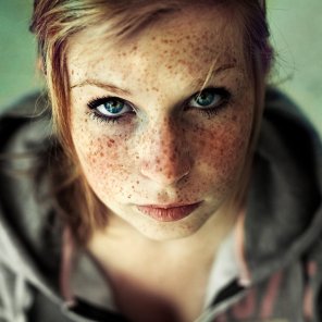 amateur-Foto Freckles