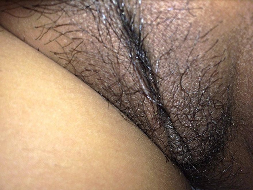 Hairy closeup
