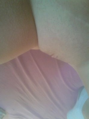 amateur-Foto Skin Pink Shoulder Joint 