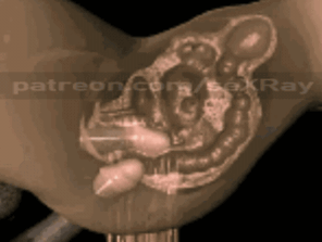 photo amateur Best gif X Ray Gifs