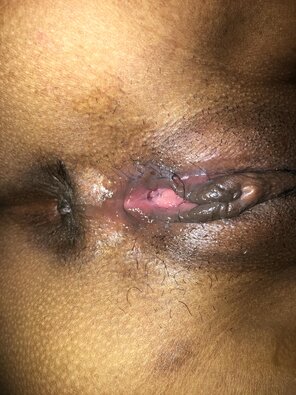zdjęcie amatorskie Closeup of my pussy lips [F]