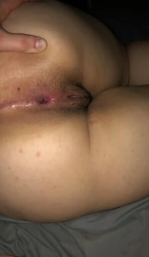 foto amadora My dilated anus after anal sex