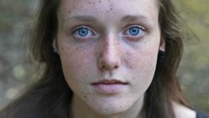 foto amateur Freckled