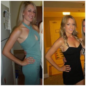 アマチュア写真 Before and after the boob job