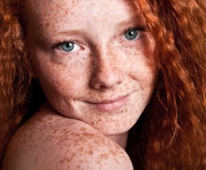 amateur photo Heavily freckled redhead
